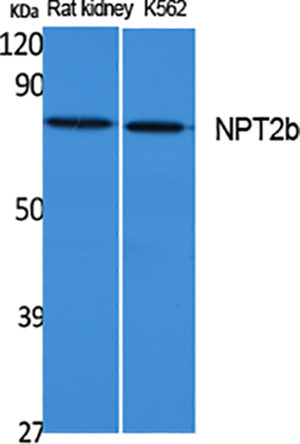 NPT2b Rabbit Polyclonal Antibody | 兔多抗 | EnkiLife恩玑生命