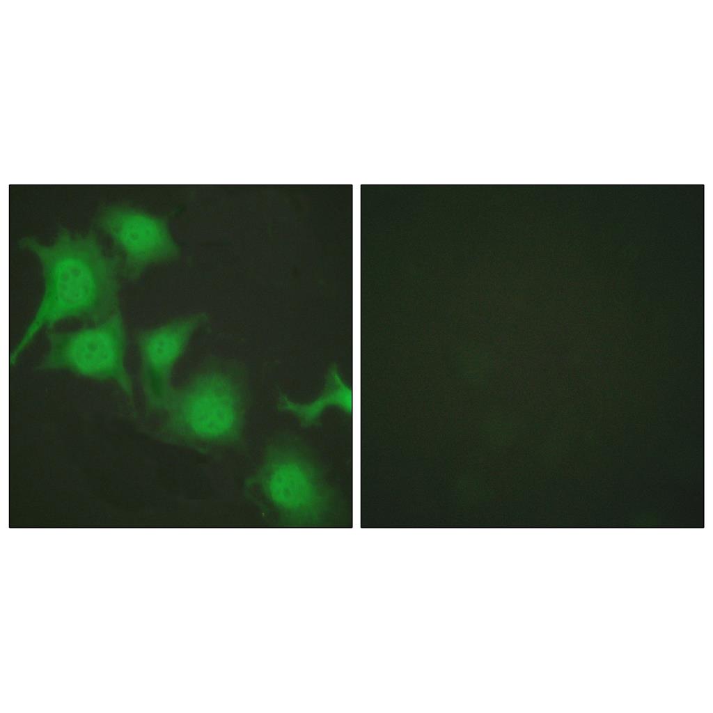 Nrf2 Rabbit Polyclonal Antibody | 兔多抗 | EnkiLife恩玑生命
