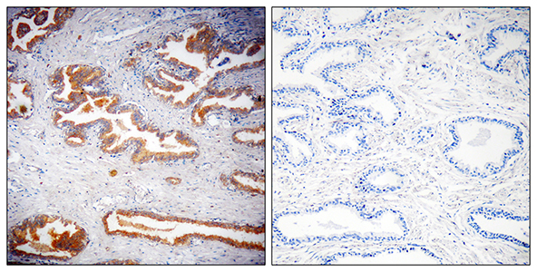 NTF2 Rabbit Polyclonal Antibody | 兔多抗 | EnkiLife恩玑生命