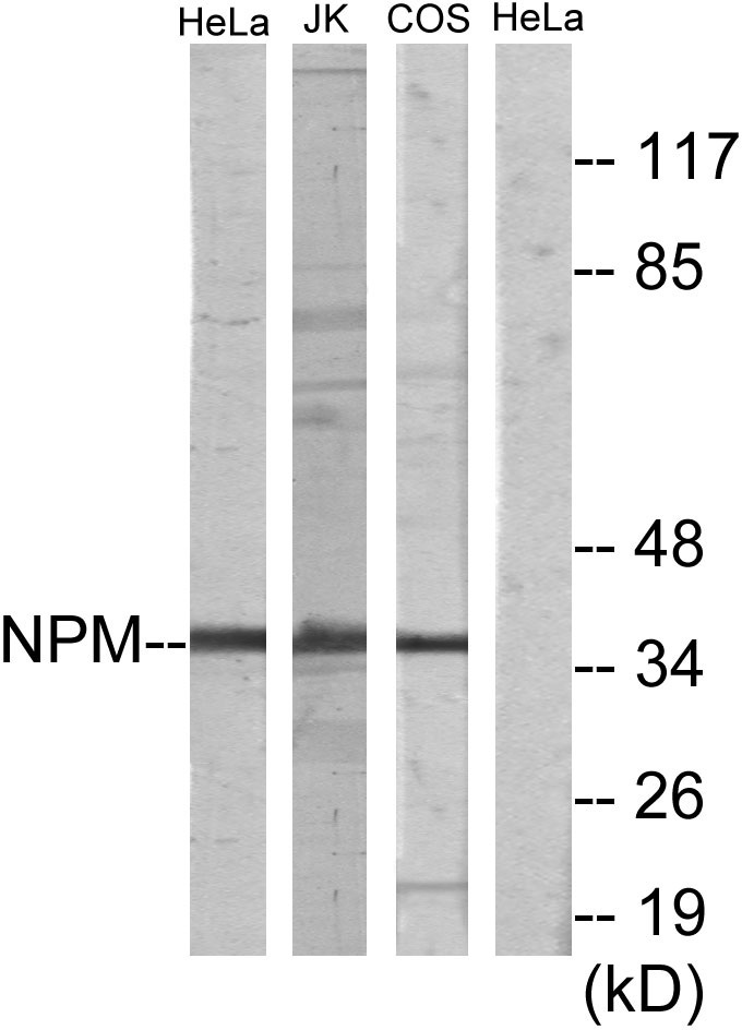 Nucleophosmin Rabbit Polyclonal Antibody | 兔多抗 | EnkiLife恩玑生命
