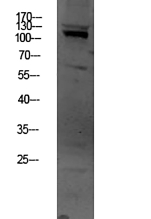 OGT Rabbit Polyclonal Antibody | 兔多抗 | EnkiLife恩玑生命