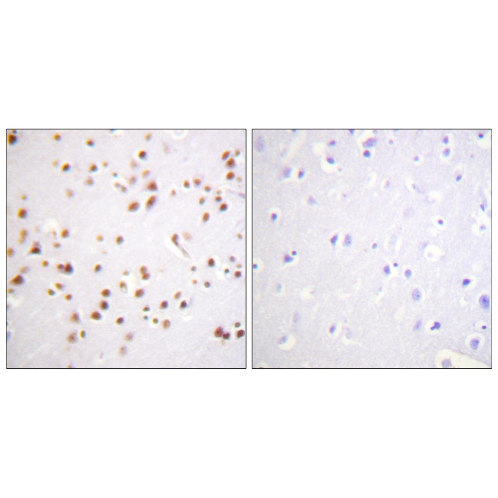 p120 Rabbit Polyclonal Antibody | 兔多抗 | EnkiLife恩玑生命