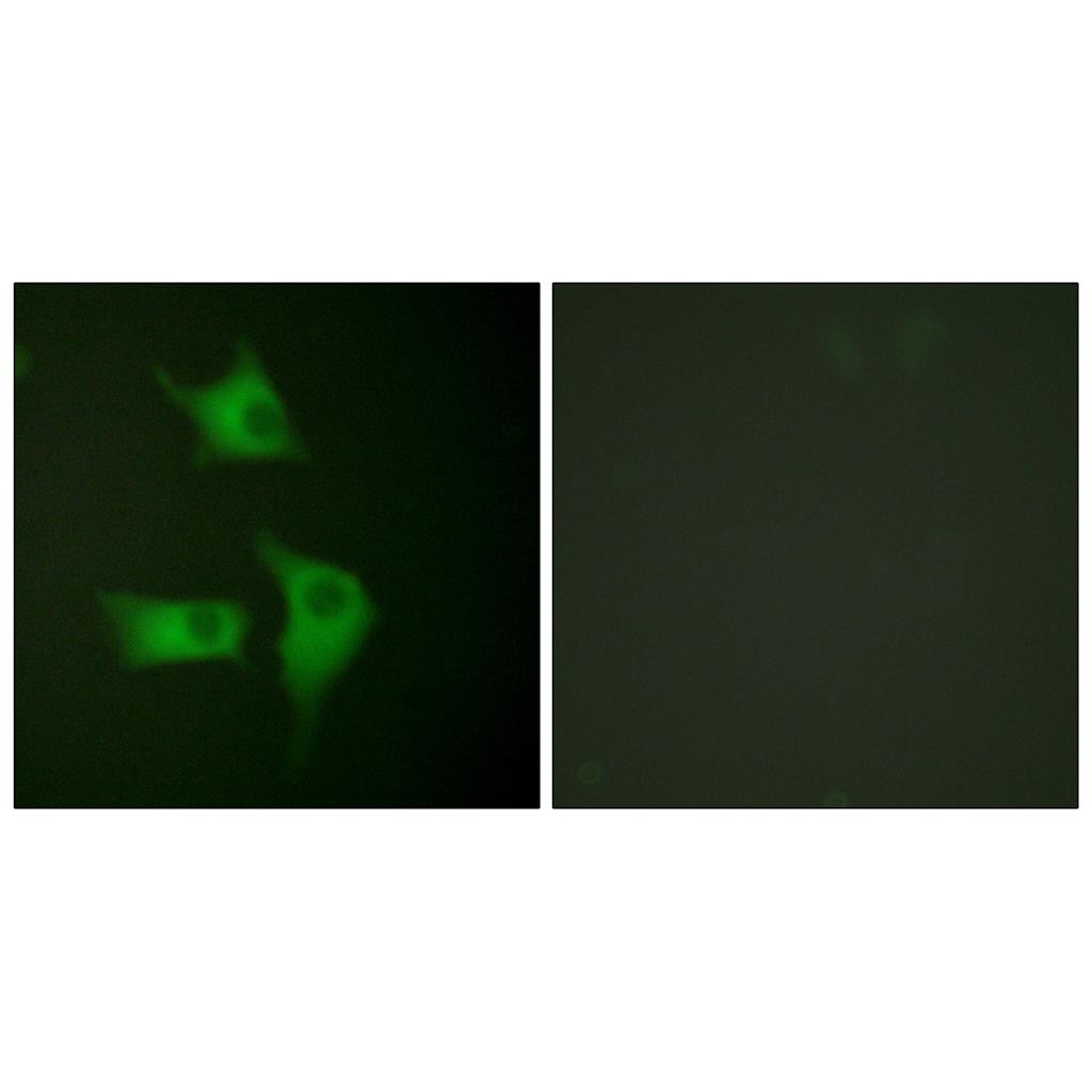 p15 Rabbit Polyclonal Antibody | 兔多抗 | EnkiLife恩玑生命