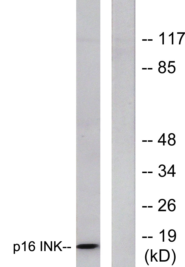 p16 Rabbit Polyclonal Antibody | 兔多抗 | EnkiLife恩玑生命