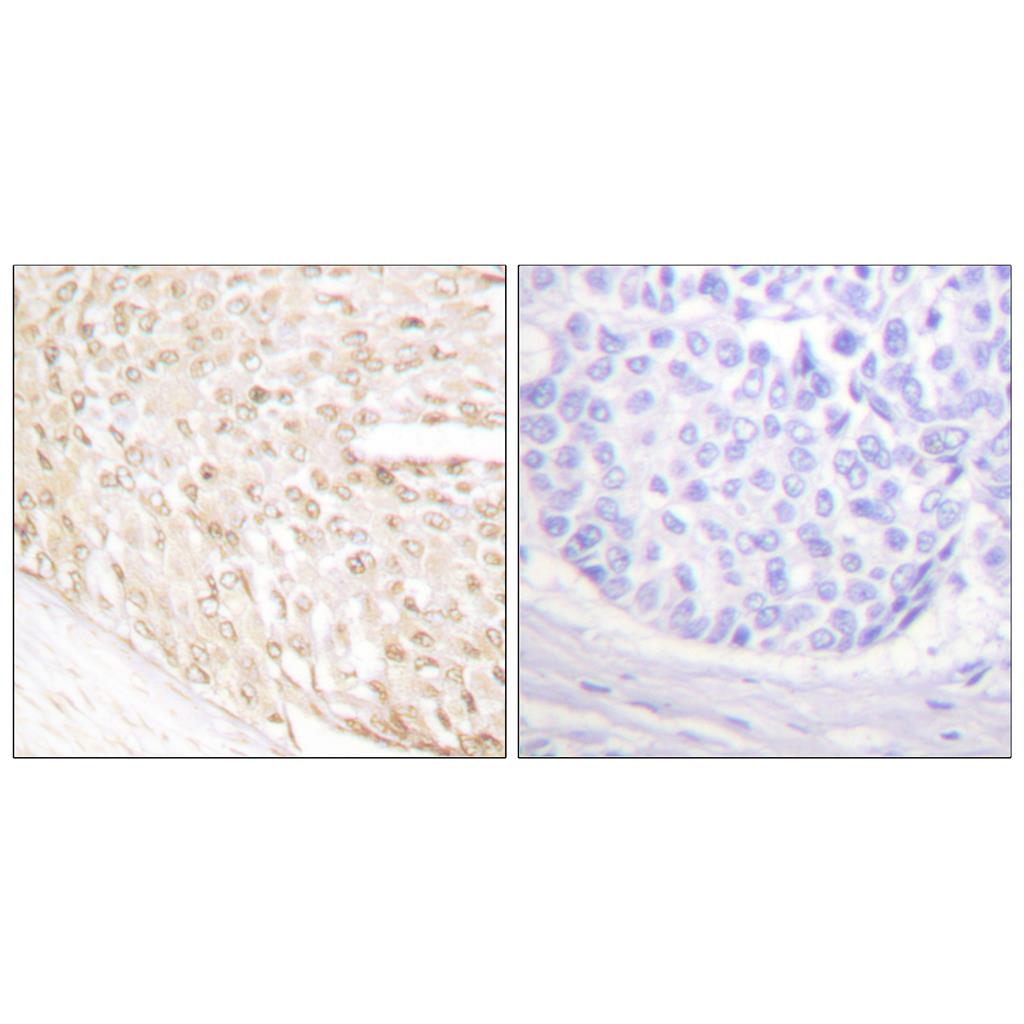 p18 Rabbit Polyclonal Antibody | 兔多抗 | EnkiLife恩玑生命