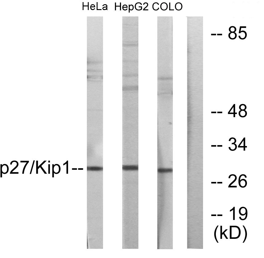 p27 Rabbit Polyclonal Antibody | 兔多抗 | EnkiLife恩玑生命