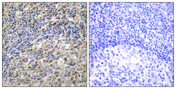 p47-phox Rabbit Polyclonal Antibody | 兔多抗 | EnkiLife恩玑生命