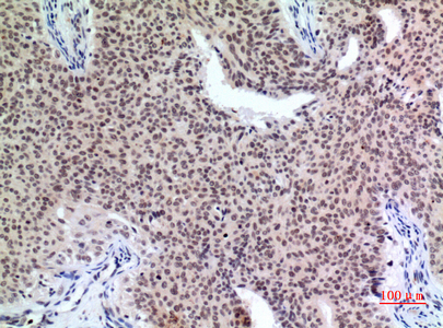 p57 Rabbit Polyclonal Antibody | 兔多抗 | EnkiLife恩玑生命