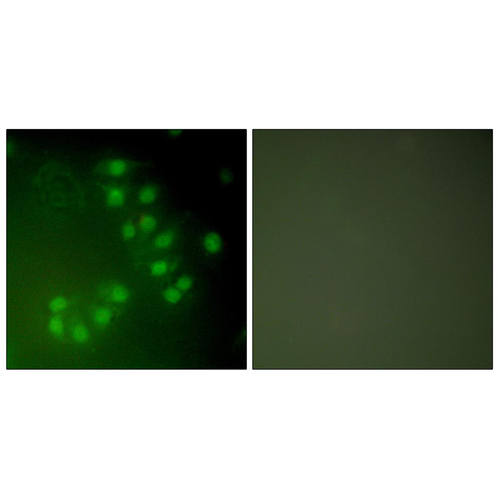 p63 Rabbit Polyclonal Antibody | 兔多抗 | EnkiLife恩玑生命