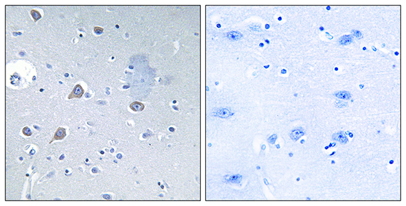 p70 S6 kinase α Rabbit Polyclonal Antibody | 兔多抗 | EnkiLife恩玑生命