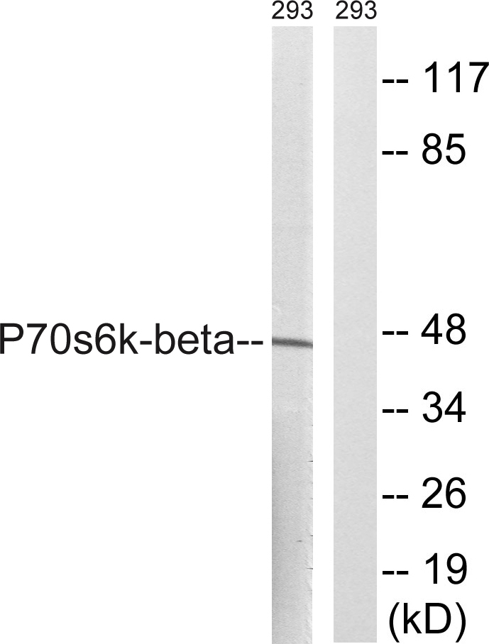 p70 S6 kinase β Rabbit Polyclonal Antibody | 兔多抗 | EnkiLife恩玑生命