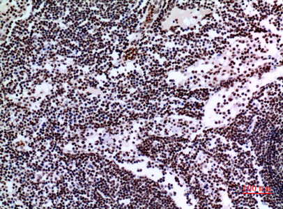 p73 Rabbit Polyclonal Antibody | 兔多抗 | EnkiLife恩玑生命