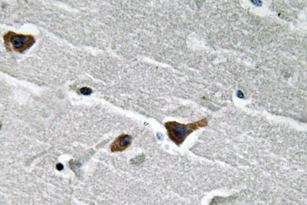 PAI-1 Rabbit Polyclonal Antibody | 兔多抗 | EnkiLife恩玑生命