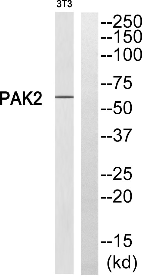 PAKγ Rabbit Polyclonal Antibody | 兔多抗 | EnkiLife恩玑生命