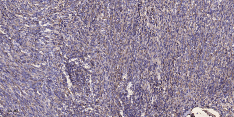 Palladin Rabbit Polyclonal Antibody | 兔多抗 | EnkiLife恩玑生命
