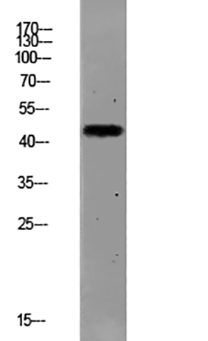 PAR1 (Cleaved-Ser42) Rabbit Polyclonal Antibody | 兔多抗 | EnkiLife恩玑生命