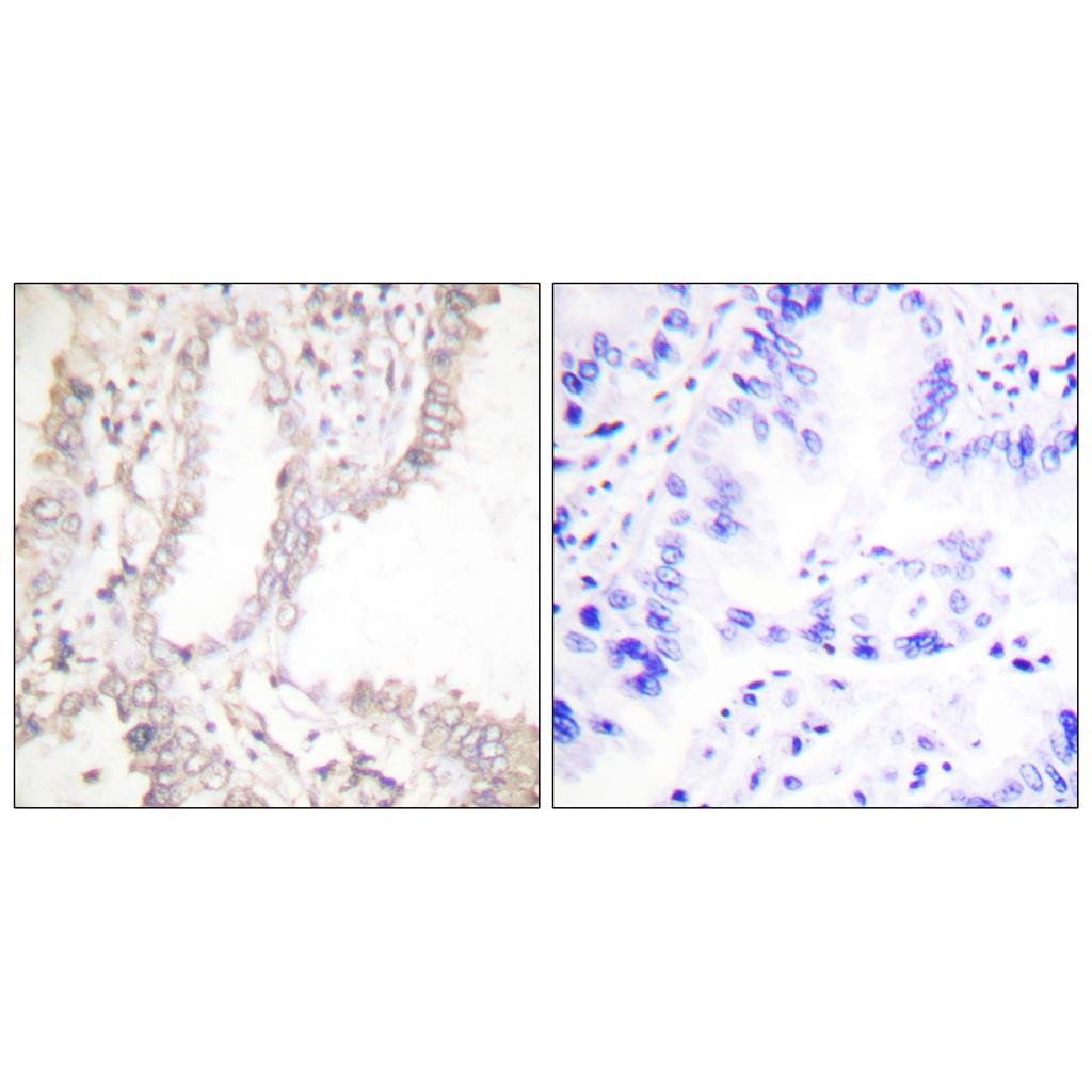 PAR4 Rabbit Polyclonal Antibody | 兔多抗 | EnkiLife恩玑生命