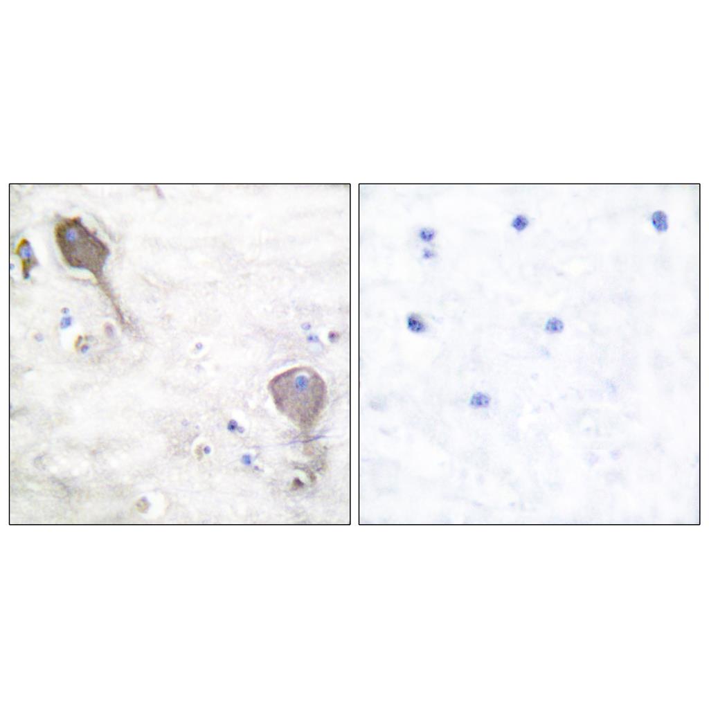 PARK2 Rabbit Polyclonal Antibody | 兔多抗 | EnkiLife恩玑生命