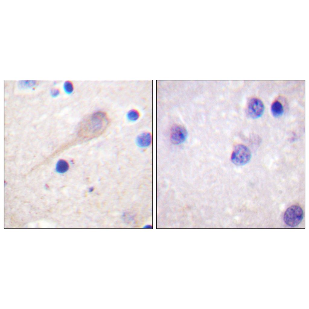 Parkin Rabbit Polyclonal Antibody | 兔多抗 | EnkiLife恩玑生命