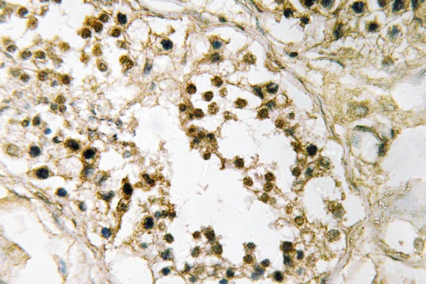Pax-2 Rabbit Polyclonal Antibody | 兔多抗 | EnkiLife恩玑生命