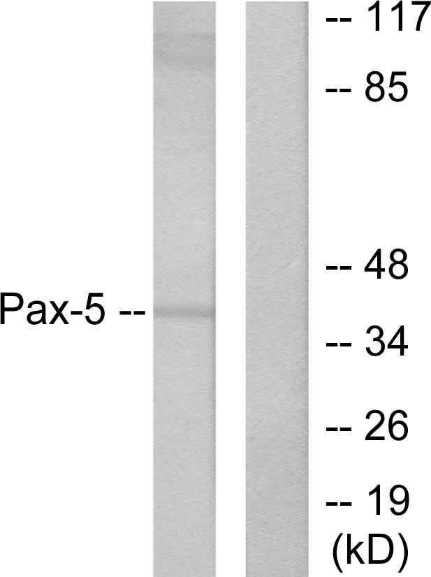 Pax-5 Rabbit Polyclonal Antibody | 兔多抗 | EnkiLife恩玑生命