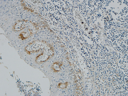 Pax-8 Rabbit Polyclonal Antibody | 兔多抗 | EnkiLife恩玑生命