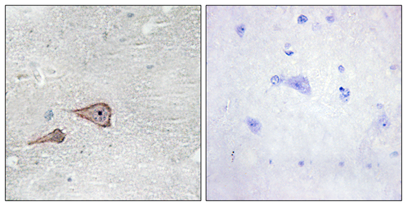 P-cadherin Rabbit Polyclonal Antibody | 兔多抗 | EnkiLife恩玑生命