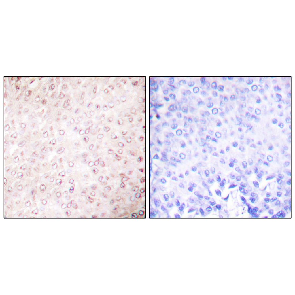 PCAF Rabbit Polyclonal Antibody | 兔多抗 | EnkiLife恩玑生命