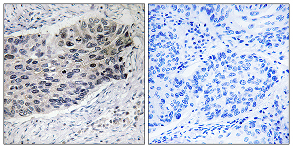 PCB Rabbit Polyclonal Antibody | 兔多抗 | EnkiLife恩玑生命