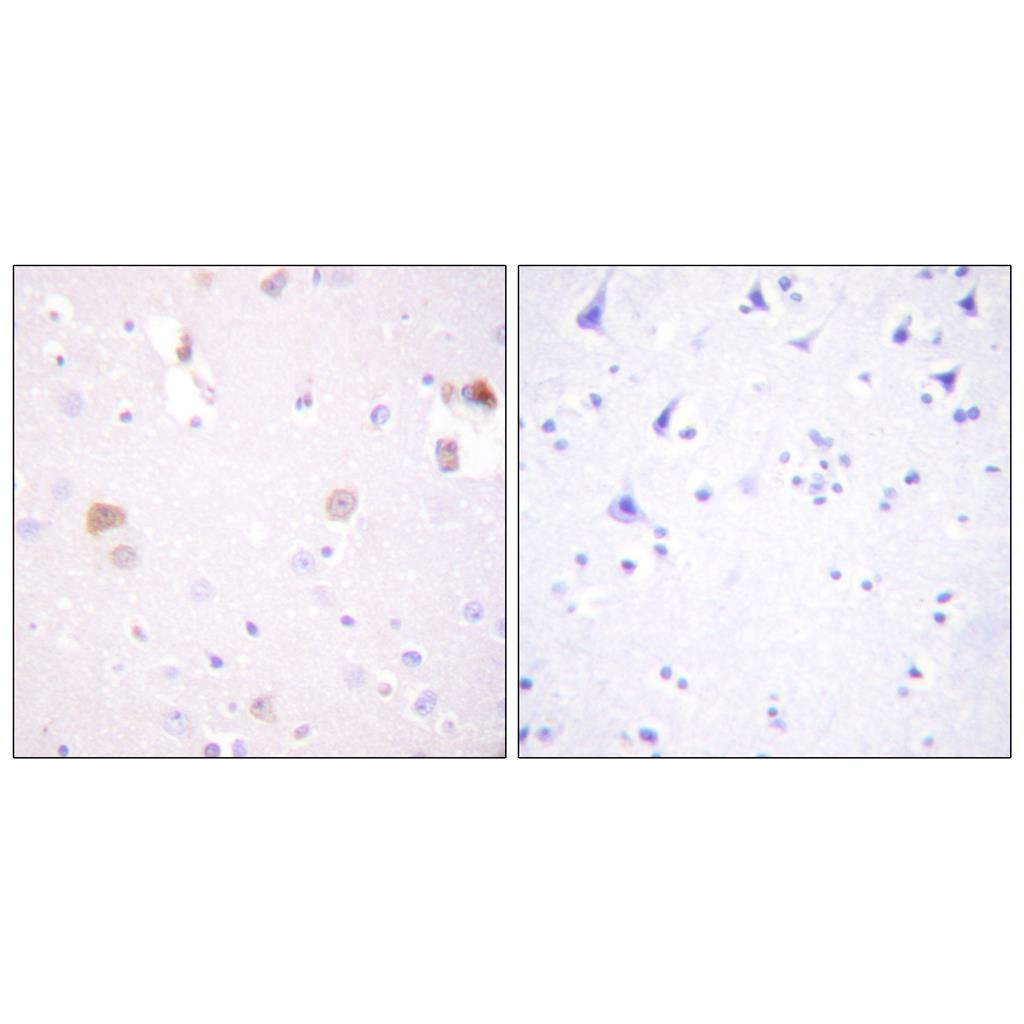 PC-PLD1 Rabbit Polyclonal Antibody | 兔多抗 | EnkiLife恩玑生命