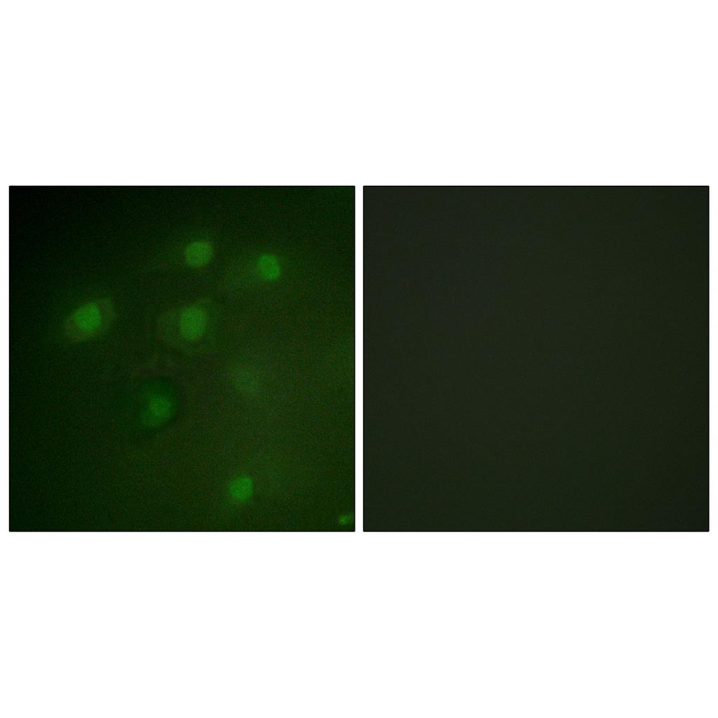 Pdcd-4 Rabbit Polyclonal Antibody | 兔多抗 | EnkiLife恩玑生命