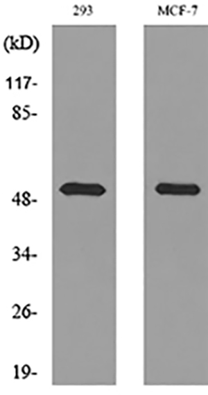 PD-ECGF Rabbit Polyclonal Antibody | 兔多抗 | EnkiLife恩玑生命