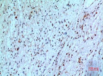 PD-ECGF Rabbit Polyclonal Antibody | 兔多抗 | EnkiLife恩玑生命