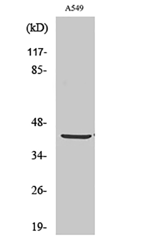 PDHA1 Rabbit Polyclonal Antibody | 兔多抗 | EnkiLife恩玑生命
