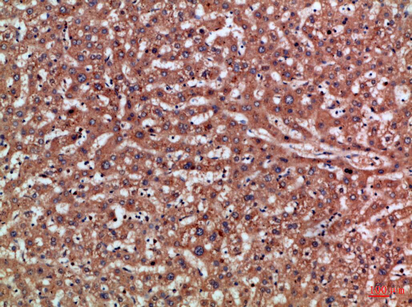 PD-L2 Rabbit Polyclonal Antibody | 兔多抗 | EnkiLife恩玑生命
