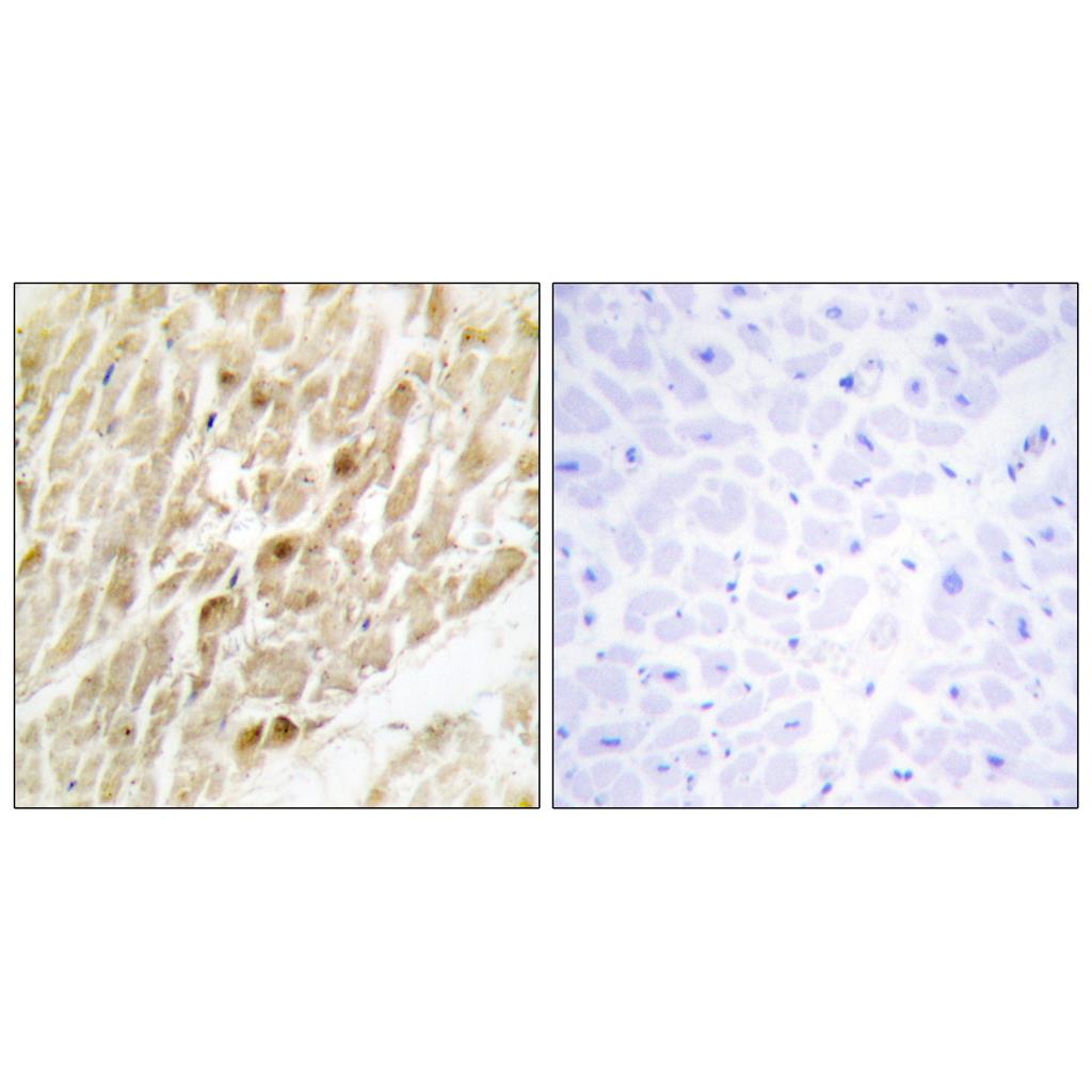 PEBP2β Rabbit Polyclonal Antibody | 兔多抗 | EnkiLife恩玑生命