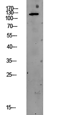 PEK/PERK Rabbit Polyclonal Antibody | 兔多抗 | EnkiLife恩玑生命
