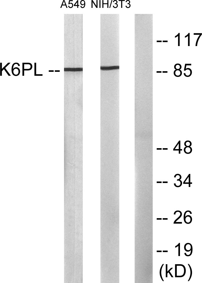 PFK-B Rabbit Polyclonal Antibody | 兔多抗 | EnkiLife恩玑生命