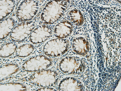 PGD Rabbit Polyclonal Antibody | 兔多抗 | EnkiLife恩玑生命