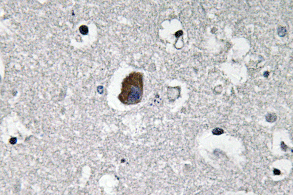 P-glycoprotein 1 Rabbit Polyclonal Antibody | 兔多抗 | EnkiLife恩玑生命