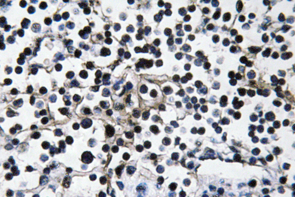 PI 3-kinase p110α Rabbit Polyclonal Antibody | 兔多抗 | EnkiLife恩玑生命