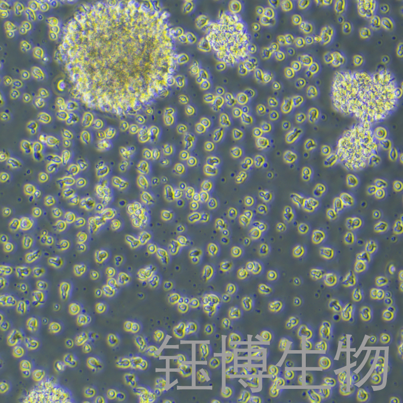 GM12878（人B淋巴细胞）YB-72035HC