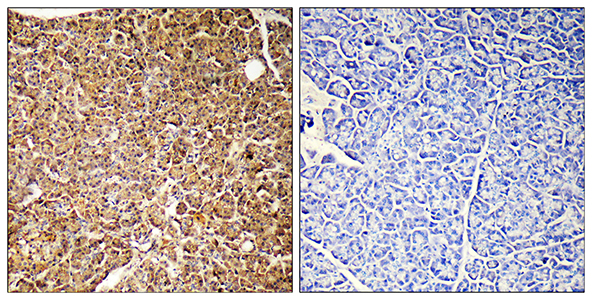 PI 3-Kinase p110γ Rabbit Polyclonal Antibody | 兔多抗 | EnkiLife恩玑生命
