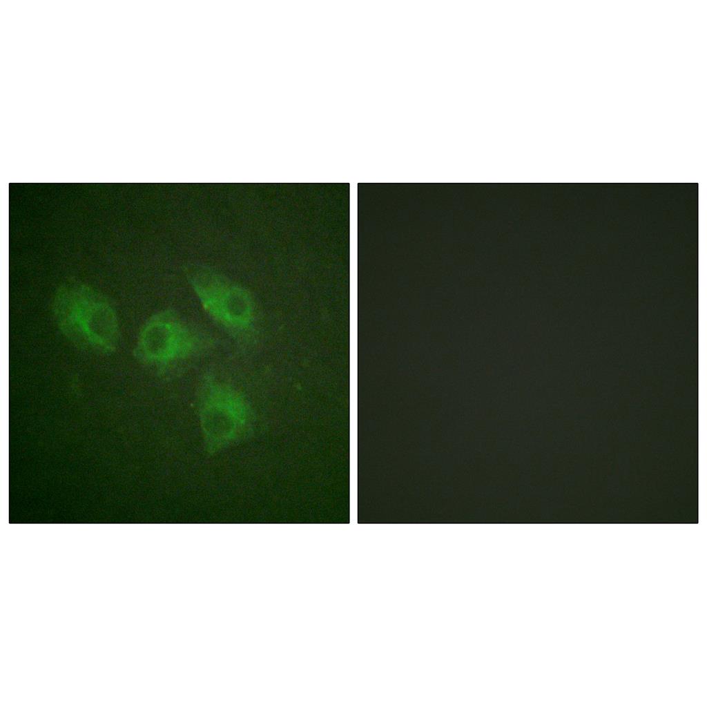 PI 3-kinase p85α Rabbit Polyclonal Antibody | 兔多抗 | EnkiLife恩玑生命