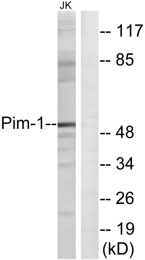 Pim-1 Rabbit Polyclonal Antibody | 兔多抗 | EnkiLife恩玑生命