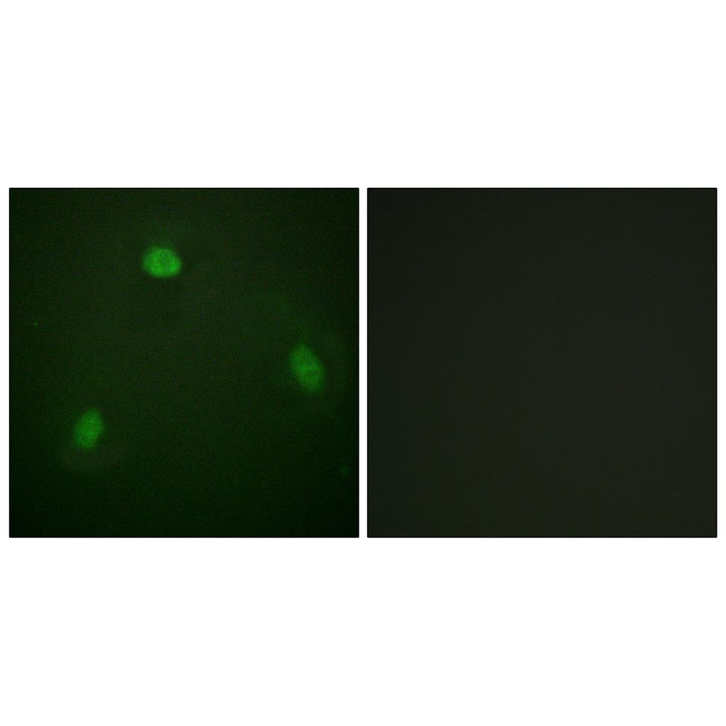 Pin1 Rabbit Polyclonal Antibody | 兔多抗 | EnkiLife恩玑生命