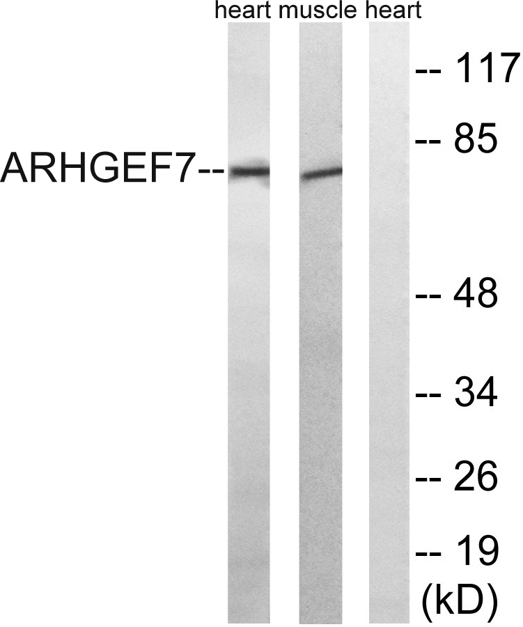 PIXβ Rabbit Polyclonal Antibody | 兔多抗 | EnkiLife恩玑生命