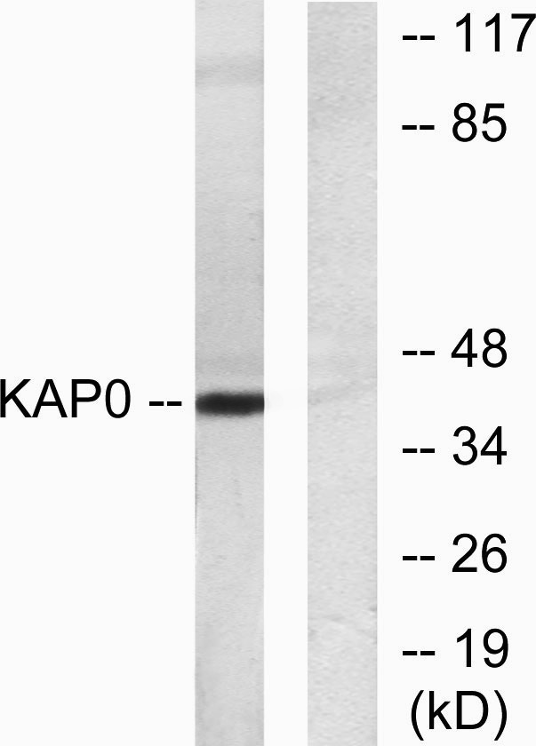 PKA Iα reg Rabbit Polyclonal Antibody | 兔多抗 | EnkiLife恩玑生命