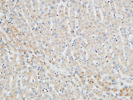 PKC α Rabbit Polyclonal Antibody | 兔多抗 | EnkiLife恩玑生命