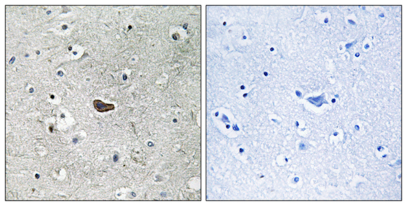 PKC δ Rabbit Polyclonal Antibody | 兔多抗 | EnkiLife恩玑生命